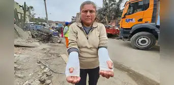 Mujer intentó salvar sus cosas en incendio en Pamplona Alta, pero se quemó ambos brazos: “No tengo nada” Mujer intentó salvar sus cosas en incendio en Pamplona Alta, pero se quemó ambos brazos: “No tengo nada”