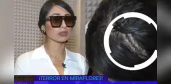 Bárbara Cam, exMiss Perú Áncash, denuncia brutal agresión en conocida discoteca: le rompieron la cabeza y tuvieron que ponerle varios puntos