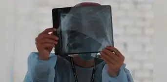 Perú es el país de América Latina con más casos de tuberculosis, según la OMS: Minsa reportó más de 33.000 pacientes en 2024