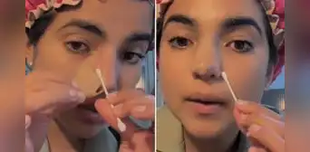 Susana Alvarado de Corazón Serrano muestra cómo luce su renovada nariz y enseña paso a paso su cuidado postoperatorio: "Va excelente" Susana Alvarado de Corazón Serrano muestra cómo luce su renovada nariz y enseña paso a paso su cuidado postoperatorio: "Va excelente"