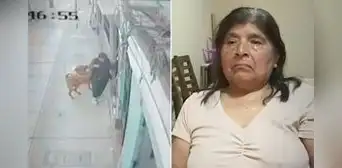 Adulta mayor resulta herida tras brutal ataque de dos perros en La Victoria: "No puedo dormir"