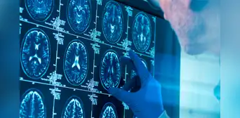No es en la adolescencia: científicos revelan la edad en que el cerebro llega a la madurez y cuándo empieza a envejecer No es en la adolescencia: científicos revelan la edad en que el cerebro llega a la madurez y cuándo empieza a envejecer