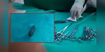 Larvas de mosca caen del techo durante cirugías en el Hospital Materno Infantil de Huancayo y desatan alarma sanitaria Larvas de mosca caen del techo durante cirugías en el Hospital Materno Infantil de Huancayo y desatan alarma sanitaria