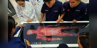 UCV apuesta por la innovación médica e implementa laboratorio con disección virtual en Los Olivos UCV apuesta por la innovación médica e implementa laboratorio con disección virtual en Los Olivos