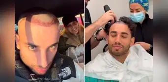 Said Palao impacta al mostrar su nueva imagen tras perder todo su cabello en tratamiento estético en España: “Esto recién empieza” Said Palao impacta al mostrar su nueva imagen tras perder todo su cabello en tratamiento estético en España: “Esto recién empieza”