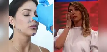 Sheyla Rojas evalúa revertir sus procedimientos estéticos: "Me había puesto tanto ácido hialurónico" Sheyla Rojas evalúa revertir sus procedimientos estéticos: "Me había puesto tanto ácido hialurónico"