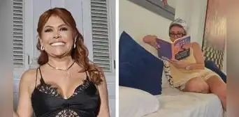Magaly Medina comparte sin filtros su proceso de recuperación tras cirugía facial: “Mostrándoles orgullosamente mis moretones”