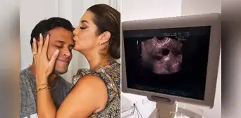 Karla Tarazona y Christian Domínguez acuden a clínica de fertilidad y sorprenden al mostrar ecografía: "Falta poco para el gran día"