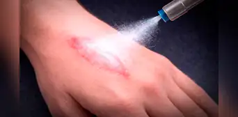 Científicos surcoreanos crean una innovadora sustancia en polvo para detener hemorragias graves solo en segundos Científicos surcoreanos crean una innovadora sustancia en polvo para detener hemorragias graves solo en segundos