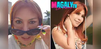 ¡Vuelve a la TV! Magaly Medina anuncia fecha de estreno de su programa en ATV tras recuperarse de su cirugía facial ¡Vuelve a la TV! Magaly Medina anuncia fecha de estreno de su programa en ATV tras recuperarse de su cirugía facial