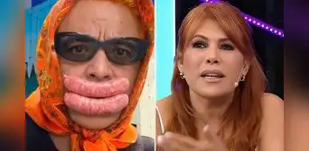 Jorge Benavides se pronuncia sobre reacción de Magaly Medina por parodiar su cirugía estética: "A la señora no le ha gustado mucho"