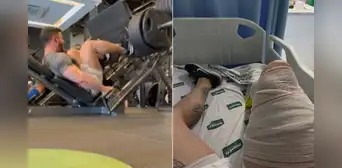 Fisiculturista en Brasil sufre una dura lesión al cargar 400 kg en un ejercicio de piernas: ''El dolor después de la operación fue mucho más intenso''