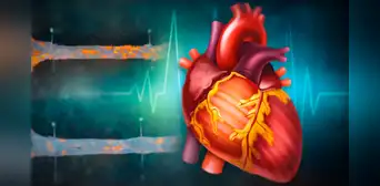 Científicos de EE.UU. desarrollan una inmunoterapia que podría limpiar arterias en pacientes con enfermedades cardiacas por colesterol