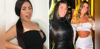 Hermana de Yahaira Plasencia confiesa que se sometió a cirugía estética y sorprende al aparecer en silla de ruedas