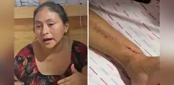 Madre embarazada quedó postrada tras caer seis metros en obra municipal sin señalización en VES: bebé nació con una fractura Madre embarazada quedó postrada tras caer seis metros en obra municipal sin señalización en VES: bebé nació con una fractura