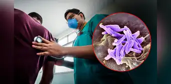 Falta de medicinas expone a pacientes con TBC resistente a graves secuelas