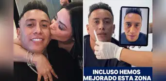 Christian Cueva sorprende al someterse a tratamiento de masculinización y muestra resultados en su rostro