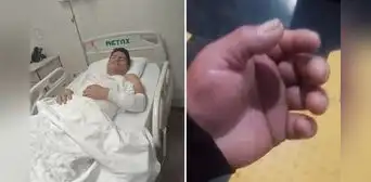 Agente de la ATU agredido con un martillo en el Metropolitano por pasajero denuncia falta de apoyo y la no renovación de su contrato: "Me abandonaron a mi suerte"