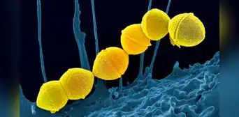 Una momia prehispánica revela que la bacteria de la faringitis ya existía en América antes de la llegada de los europeos