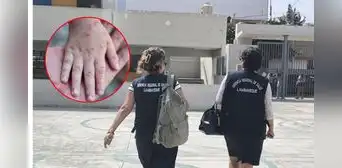 Alerta por virus coxsakie: 38 colegios de Chiclayo reportan el brote de la enfermedad de mano, pie y boca entre sus alumnos Alerta por virus coxsakie: 38 colegios de Chiclayo reportan el brote de la enfermedad de mano, pie y boca entre sus alumnos