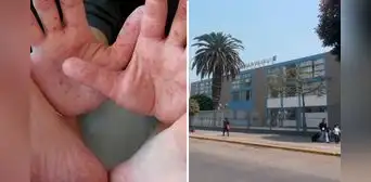 Suspenden clases presenciales en colegio de Lince por contagio de virus Coxsackie que afecta manos, pies y boca en alumnos Suspenden clases presenciales en colegio de Lince por contagio de virus Coxsackie que afecta manos, pies y boca en alumnos