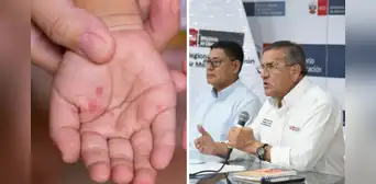 ¿Cerrarán colegios por virus Coxsackie? Esto dijo el Minedu ante el aumento de contagios en Lima y regiones ¿Cerrarán colegios por virus Coxsackie? Esto dijo el Minedu ante el aumento de contagios en Lima y regiones