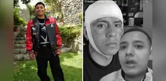 Streamer Ángel Ramírez sufre golpiza en discoteca y termina herido tras corte en la frente