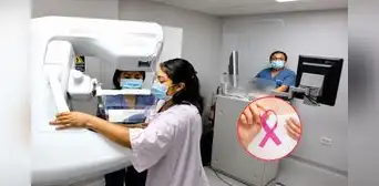 ¿Necesitas una mamografía? Hospital Santa Rosa ofrece este examen médico 100% gratuito sin seguro ni orden médica desde esta fecha