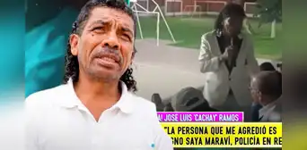 Cómico 'Cachay' pide ayuda tras brutal agresión en pleno show: "Uno necesita para los medicamentos"