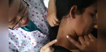 Alerta por cáncer de piel: 200 peruanos son derivados por sospecha de melanoma y Junín lidera casos