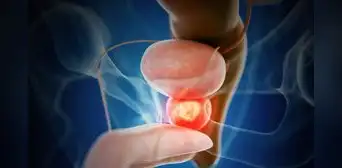 Ensayo clínico internacional demuestra eficacia de terapia combinada en cáncer de próstata agresivo: menos progresión y menor mortalidad
