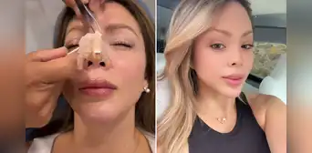 Sheyla Rojas muestra el resultado de su nueva rinoplastia tras retoque estético: "Quería que no me cambie la cara"