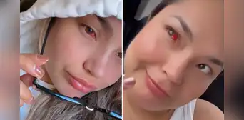 Lesly Águila aparece con aparente problema en los ojos: imágenes preocupan a los fans de Corazón Serrano Lesly Águila aparece con aparente problema en los ojos: imágenes preocupan a los fans de Corazón Serrano