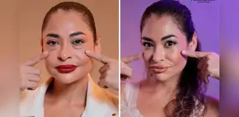 Melanie Martínez impacta al mostrar su nuevo rostro tras someterse a cirugía estética: “Gracias por devolverme la juventud” Melanie Martínez impacta al mostrar su nuevo rostro tras someterse a cirugía estética: “Gracias por devolverme la juventud”