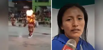 Escolar sufre graves quemaduras durante danza de tijeras con fuego en colegio de Junín: fue llevada al hospital Escolar sufre graves quemaduras durante danza de tijeras con fuego en colegio de Junín: fue llevada al hospital