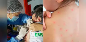 Confirman brote de sarampión en Loreto: Defensoría del Pueblo pide acciones urgentes para frenar transmisión Confirman brote de sarampión en Loreto: Defensoría del Pueblo pide acciones urgentes para frenar transmisión