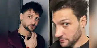 Nicola Porcella sorprende al mostrar su renovada nariz tras someterse a una nueva operación y genera reacciones