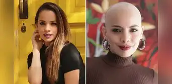 Recordada actriz de 'Así es la vida' hace fuerte confesión sobre su lucha contra el cáncer: "Esperar no es una opción"