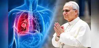Papa León XIV: ¿Qué es el adenocarcinoma pulmonar? La enfermedad la cual padece el sumo pontífice Papa León XIV: ¿Qué es el adenocarcinoma pulmonar? La enfermedad la cual padece el sumo pontífice