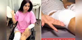 TikToker Zully recibe 40 puntos en la pierna tras sufrir aparatoso accidente y reaparece en silla de ruedas: "Tuve todos esos cortes"