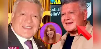 Magaly Medina expone 'nuevo rostro' de César Acuña tras someterse a cirugía y lanza cruel comentario: "Le han hecho una monstruosidad"