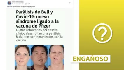 Es engañosa la vinculación de la parálisis de Bell con la vacuna Pfizer