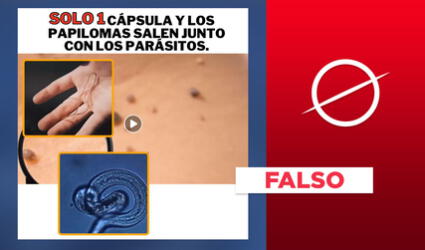 Es falso que verrugas del virus del papiloma humano se curan con productos antiparasitarios