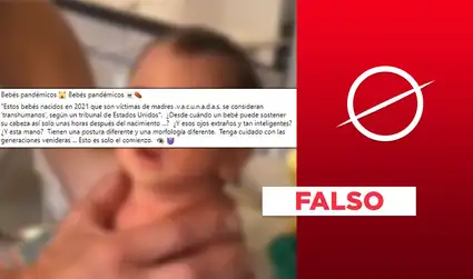 Es falso que en el video aparece una bebé “transhumana” a causa de las vacunas