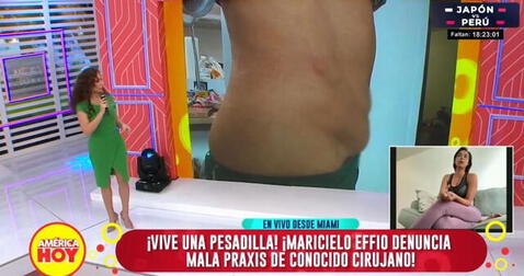 Maricielo Effio muestra pruebas de supuesta mala praxis realizada por el Dr. Fong. Foto: captura de pantalla de América Hoy   