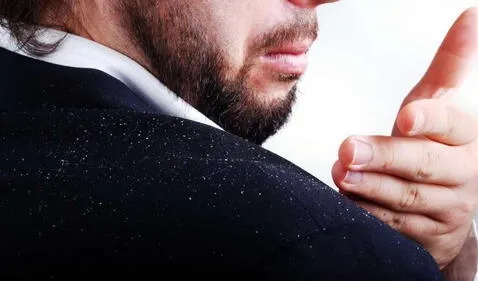 When we are stressed, does dandruff appear?