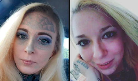 Mujer con el rostro lleno de tatuajes se sometió 3 años a eliminación con láser y así luce ahora 63d3f0e2b86e87136d1405d4