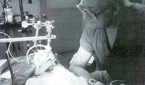 El experimento más cruel del doctor Robert White: trasplantó la cabeza de un mono a otro cuerpo 63dd8464d184a16dcd3e6e7f