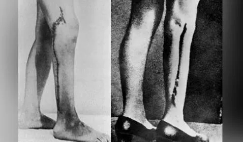 Desde mutilaciones hasta esterilizaciones: 5 experimentos más crueles de los nazis en el Holocausto 640116ec095a492304412fa2
