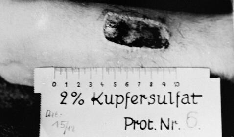 Desde mutilaciones hasta esterilizaciones: 5 experimentos más crueles de los nazis en el Holocausto 640117aa14865600363e28e0